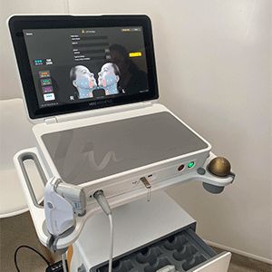 Ultherapy Prime