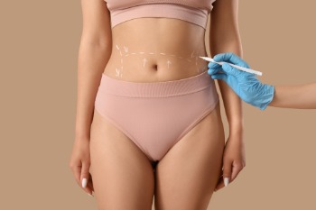 3D-lipo / 3D Aesthetics