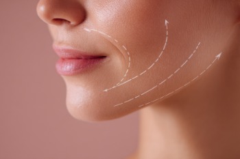 CACI